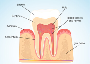 why is a root canal needed root canal coopers plains